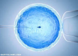 培养箱